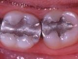Tandartspraktijk Phoa & Phoa-Provatoroff spoedhulp tandarts