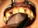 Hover Tandartspraktijk tandarts behandelstoel