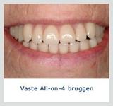 Kliniek voor Cosmetische Tandheelkunde Amsterdam Zuid tandarts behandelstoel