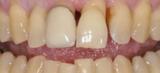 Tandartsenpraktijk W H Polet tandarts behandelstoel