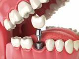 Tandheelkunde Goudsesingel tandarts behandelstoel