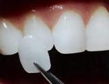 Dentex Texel tandarts
