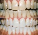 Centrum voor Tandheelkunde Marodent tandarts lachgas
