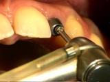 Hover Tandartspraktijk tandarts lachgas