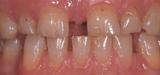 Tandartsenpraktijk W H Polet tandarts lachgas
