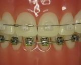 Tandartspraktijk Ringers tandarts onder narcose