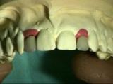 Hover Tandartspraktijk tandarts spoed