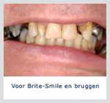 Kliniek voor Cosmetische Tandheelkunde Amsterdam Zuid tandarts spoed