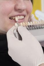 Tandheelkunde Goudsesingel tandarts spoed