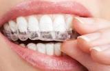 Tandheelkunde Goudsesingel tandarts