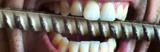 Circum Dentem Tandartspraktijk tandarts weekend
