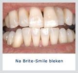 Kliniek voor Cosmetische Tandheelkunde Amsterdam Zuid tandartsen