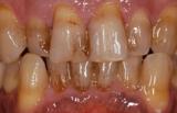 Tandartsenpraktijk W H Polet tandartsen