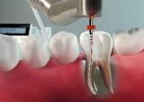 Tandheelkunde Goudsesingel tandartsen