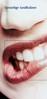 Dent10 Tandheelkundigcentrum wanneer spoed tandarts