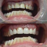Tandheelkunde Goudsesingel wanneer spoed tandarts